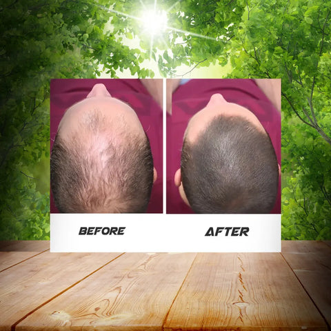 Burraqah Hair Oil | Natural Hair Fall Control & Regrowth